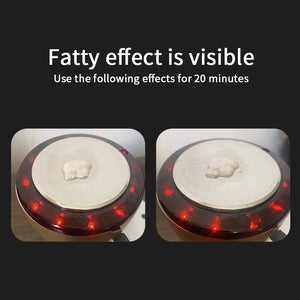 LEBELLE™ LED Ultrasonic Cavitation Massager