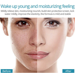 Hyaluronic Acid Serum