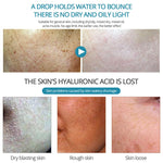 Hyaluronic Acid Serum