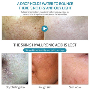 Hyaluronic Acid Serum