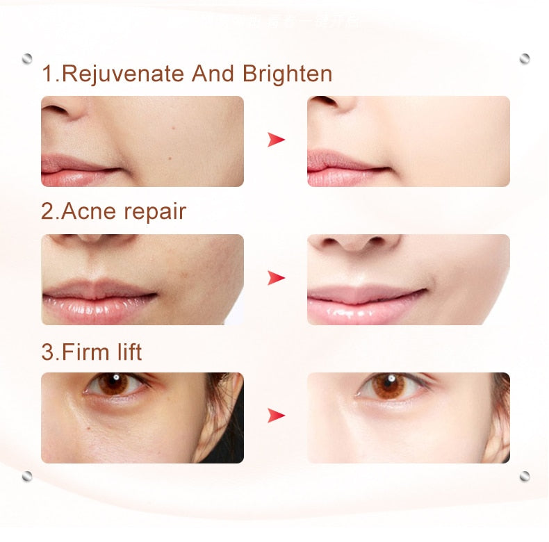 LEBELLE™ EMS 5-IN-1 ANTI-AGING DEVICE