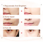 LEBELLE™ EMS 5-IN-1 ANTI-AGING DEVICE
