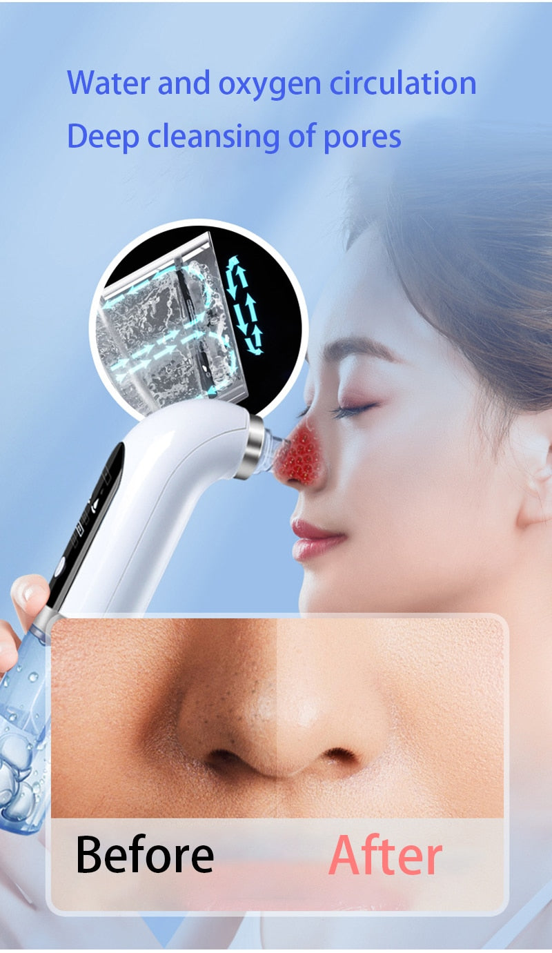 LeBelle™ Hydrodermabrasion
